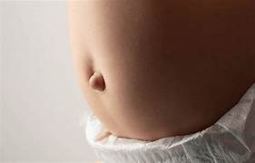 Umbilical Hernia Treatment