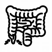 Appendicitis is an inflammation of the appendix—a small tube attached to the large intestine—commonly due to a blockage such as a fecalith, causing infection