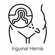 An inguinal hernia occurs when abdominal tissue (like fat or intestines) pushes through a weakened spot in the lower abdominal wall—specifically the inguinal canal, a natural passageway in the groin region  