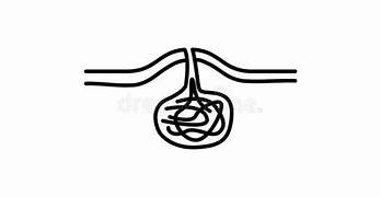 Pilonidal sinus is a medical condition that occurs due to the formation of a cyst or abscess in the cleft of the buttocks. The condition is more common in men than women and usually affects people who sit for longer periods. 