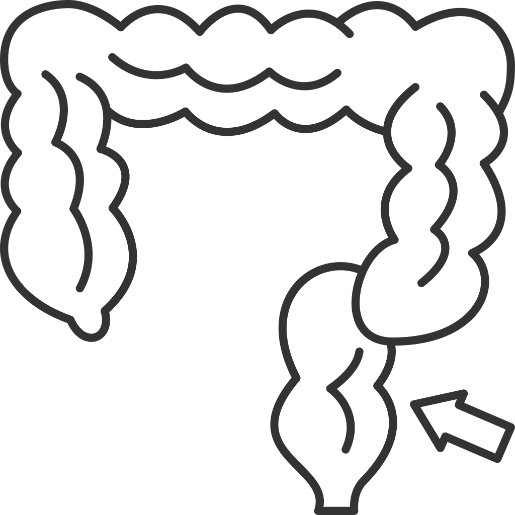 Rectal Prolapse Treatment - Diagnosis, Surgery & Recovery